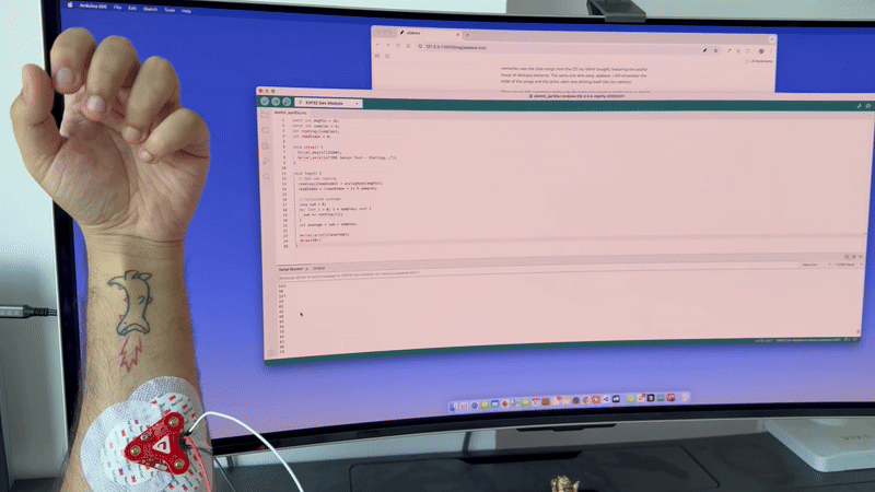 Orion EMG signal gif