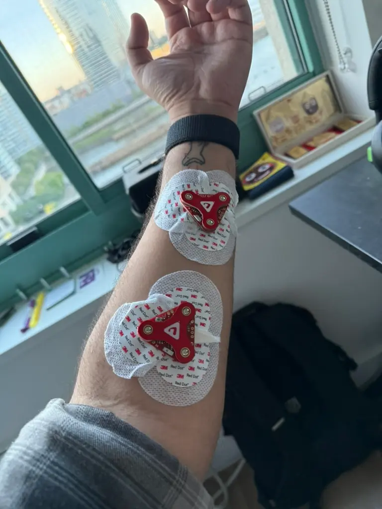 arm